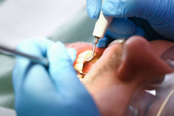 Best Emergency Denture Repair in Laguna Woods, CA